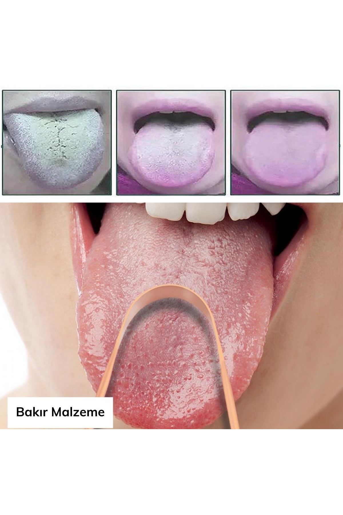 TBL Dekor® Bakır Oil Pulling Yağ Çekme Dil Plak Temizleme Aleti Dil Fırçası Sıyırıcı Dil Kaşığı